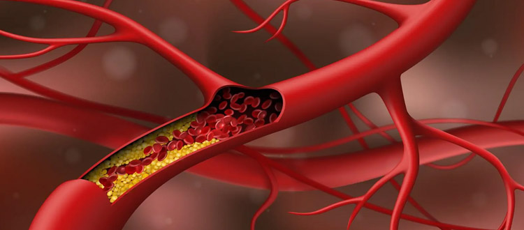 Understanding Cholesterol | ProMeals Blog